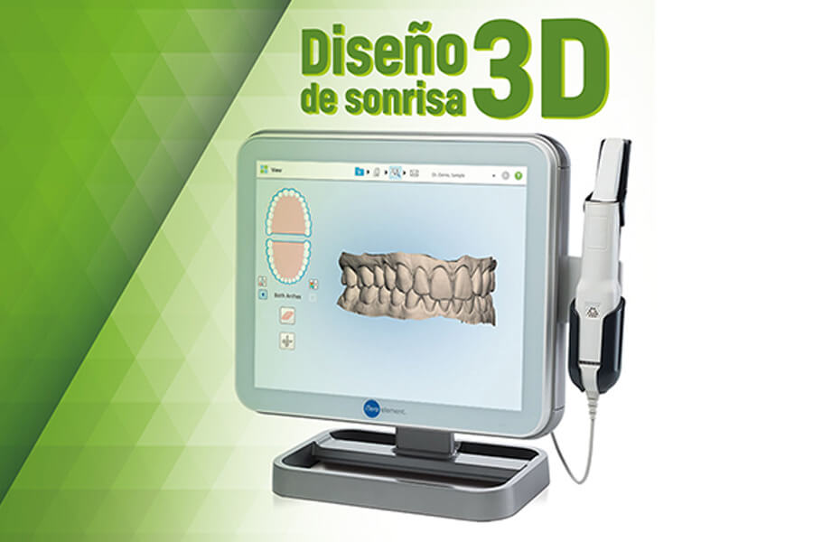 escaner 3d