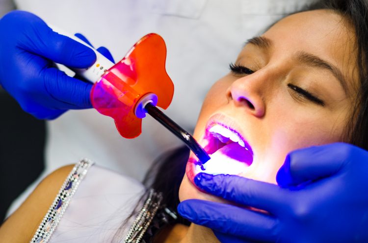 láser dental en Huelva